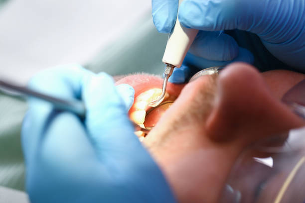 Best Emergency Dental Surgery in Dumbarton, VA
