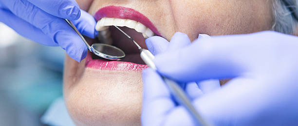 Best Emergency Tooth Extraction in Dumbarton, VA